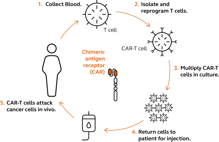 Fig 1: Car T Therapeutic Pathway